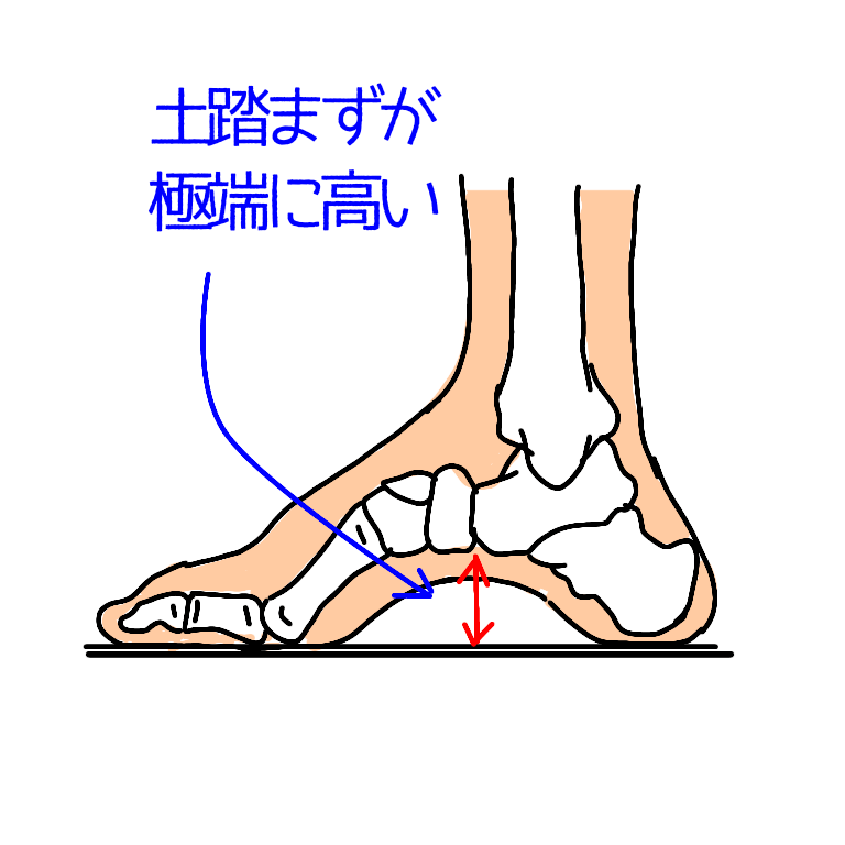 土踏まずが高い