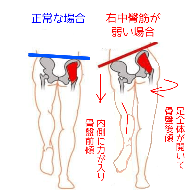 中臀筋のチェック