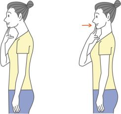 頸長筋のチェック